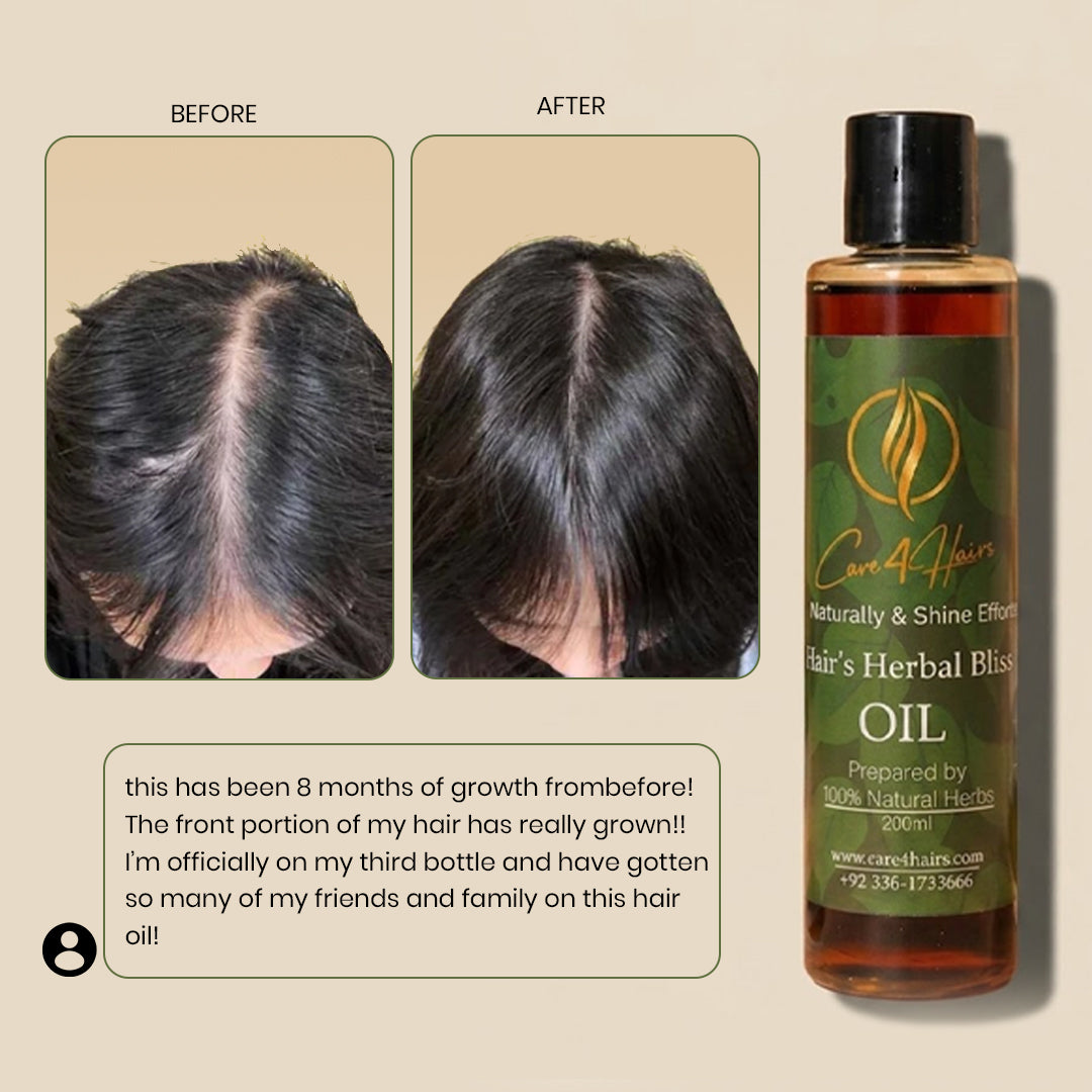 Care4Hairs Cooling Summer Scalp Detox & Freshness Oil bottle, 200ml, with dropper applicator, designed for hair fall control and scalp refreshment